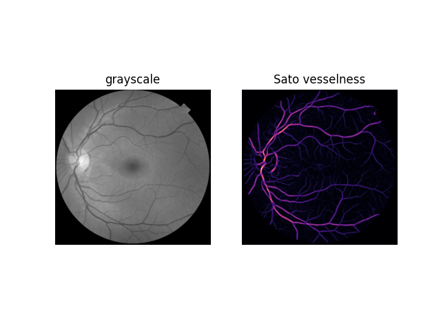 grayscale, Sato vesselness