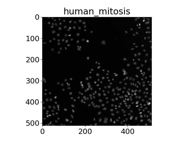 human_mitosis