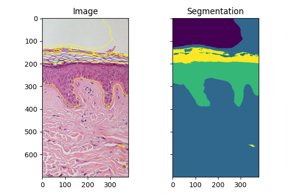 Image, Segmentation